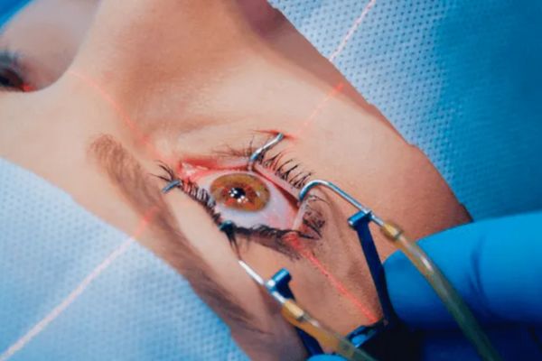 Specs Removal Operation